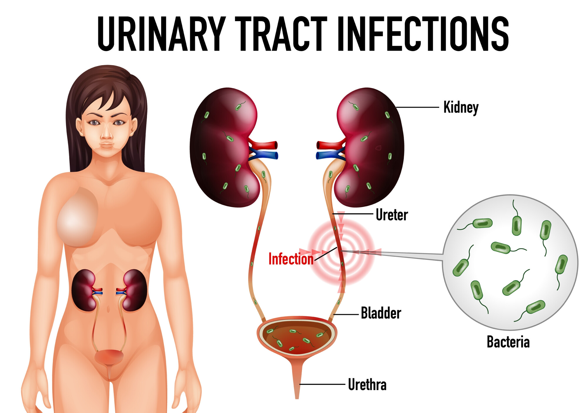 bladder emptying